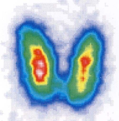 Schilddrüsendiagnostik » Radiologie Darmstadt